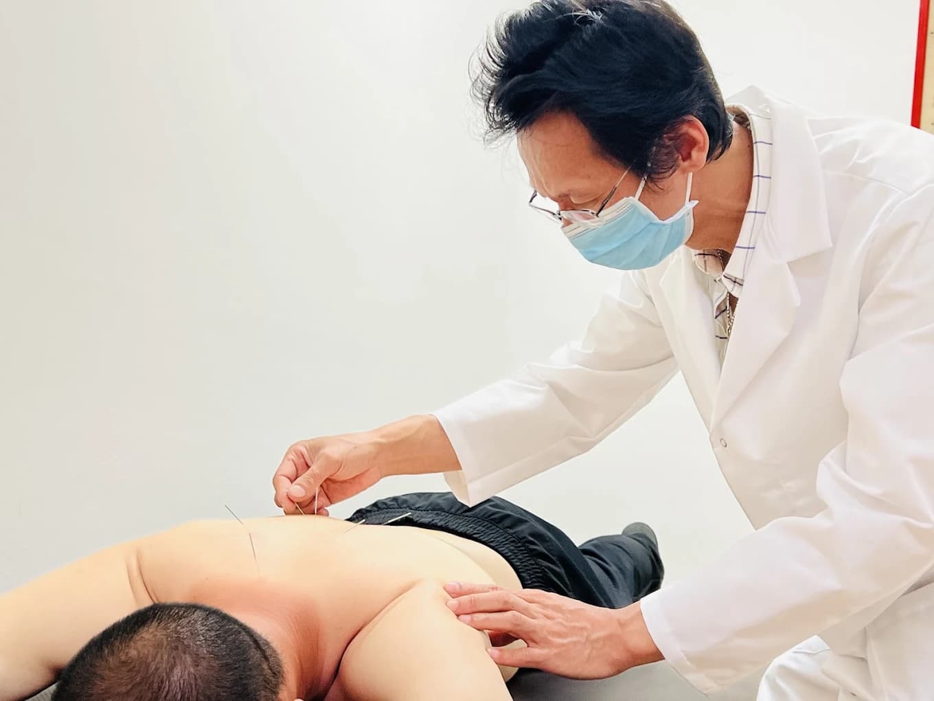 Acupuncture Intensive